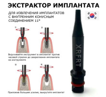 XRFRT Экстрактор имплантов 11 градусов